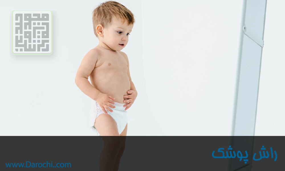 راش پوشک در نوزادان و کودکان (1)-min