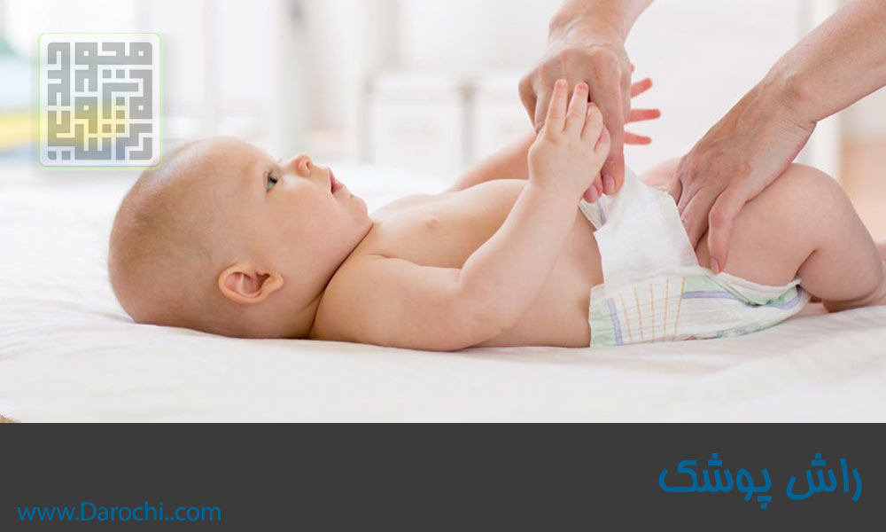 راش پوشک در نوزادان و کودکان (5)-min
