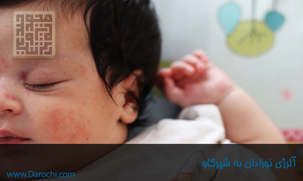 شیر خشک رژیمی چیست؟-آلرژی به شیرگاو