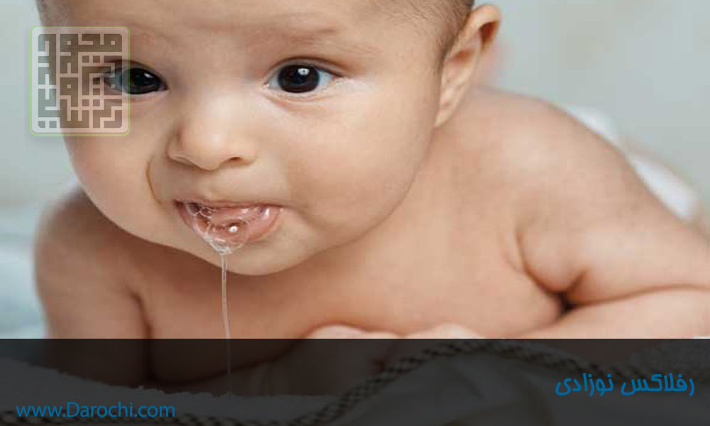 رفلاکس نوزادی- داروچی (2)