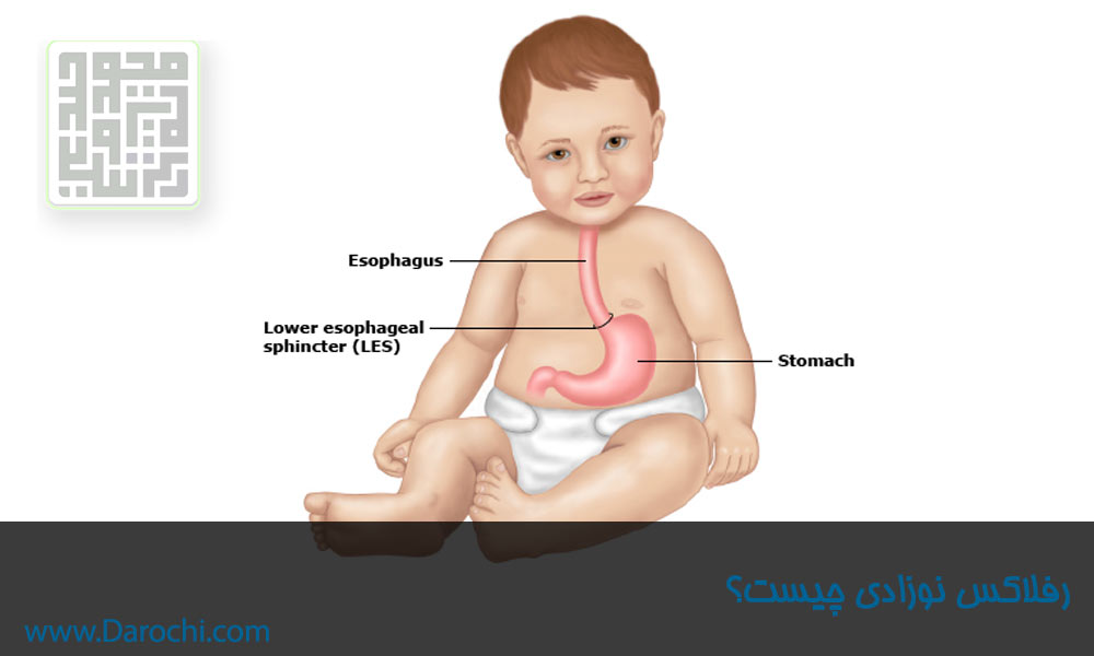 رفلاکس-نوزادی-چیست-؟-داروچی