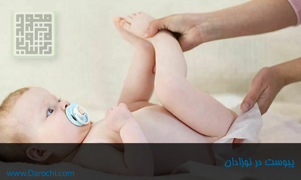 یبوست در نوزادان-داروچی