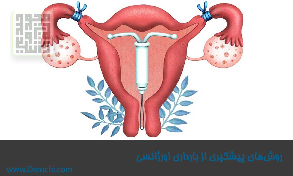 روش‌های پیشگیری از بارداری