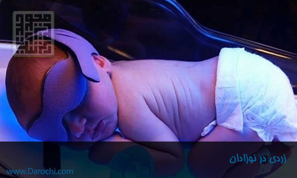 زردی در نوزادان-داروچی (1)