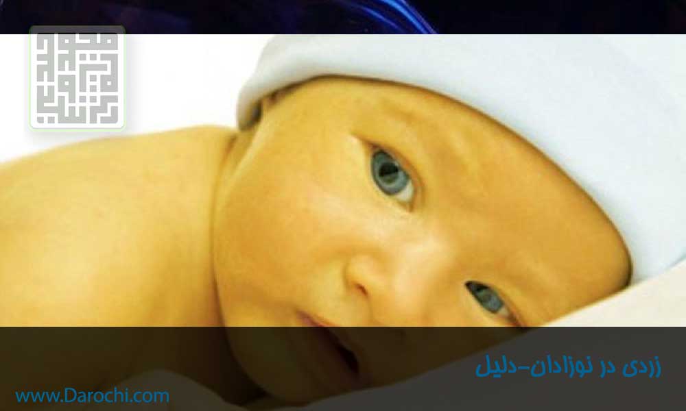 زردی در نوزادان-داروچی (2)