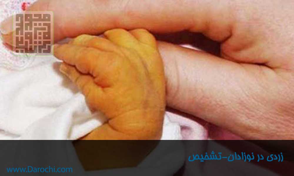 زردی در نوزادان-داروچی (7)