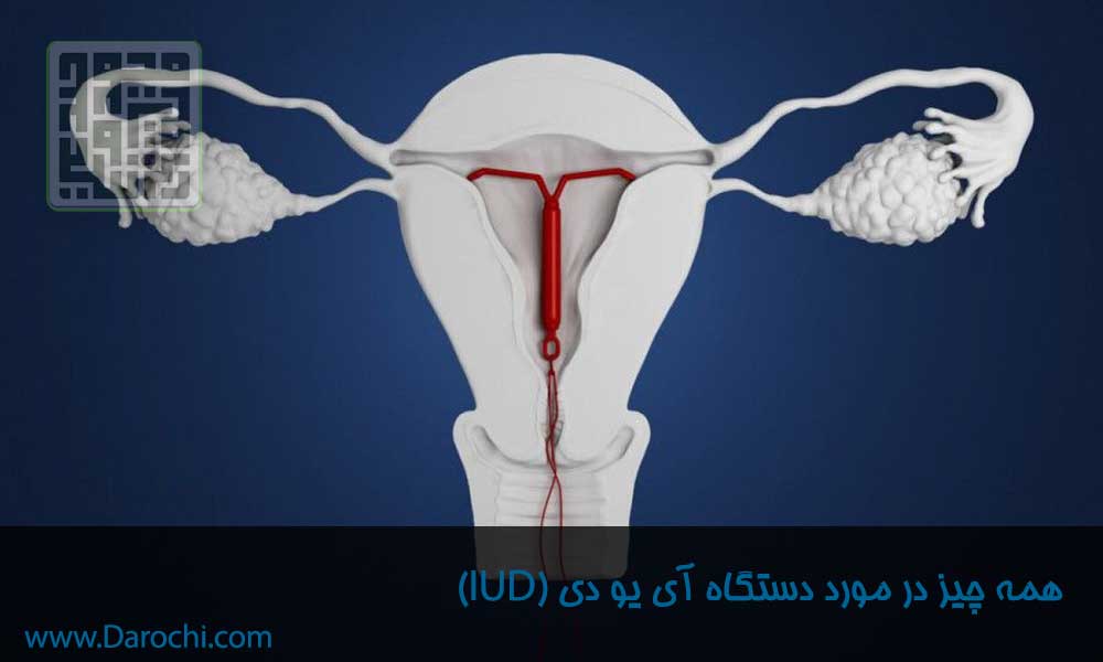 همه چیز در مورد دستگاه آی یو دی-داروچی