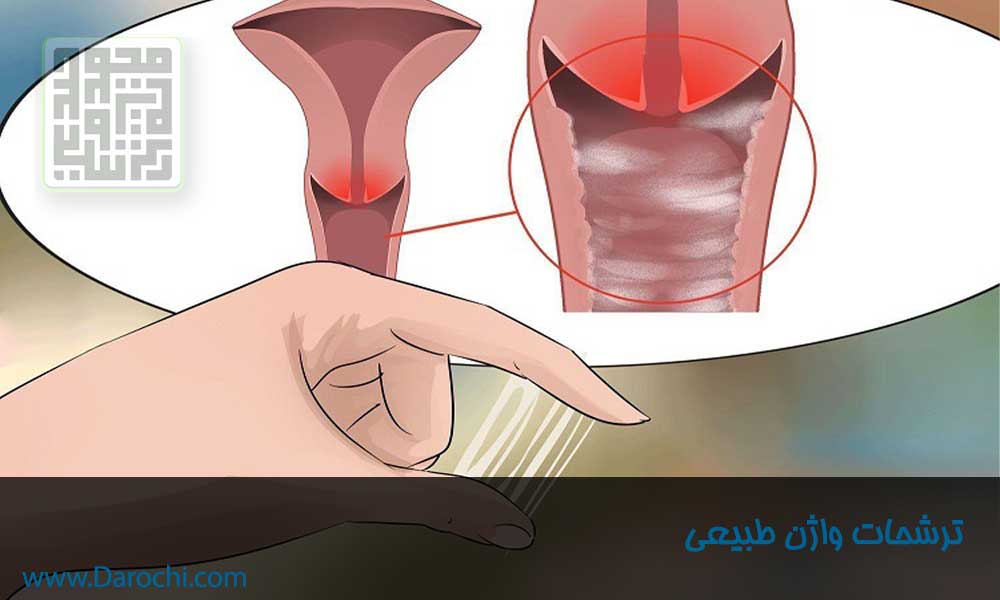 ترشحات طبیعی واژن -داروچی