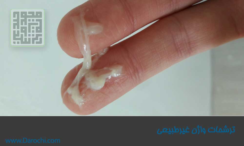 ترشحات غیرطبیعی واژن