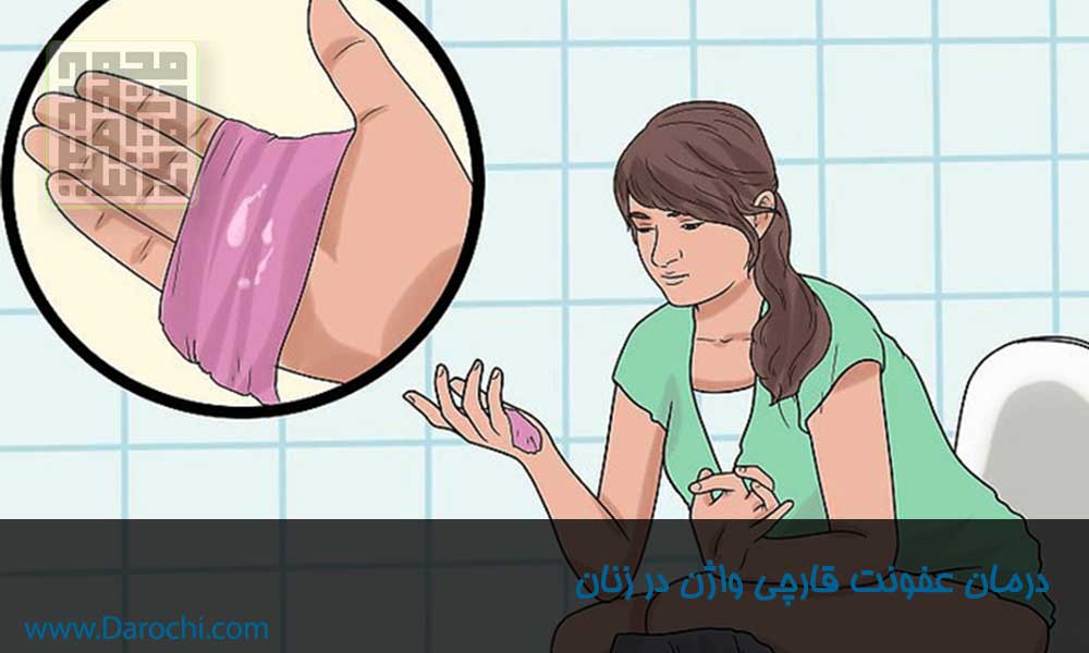 درمان عفونت قارچی واژن در زنان- داروچی