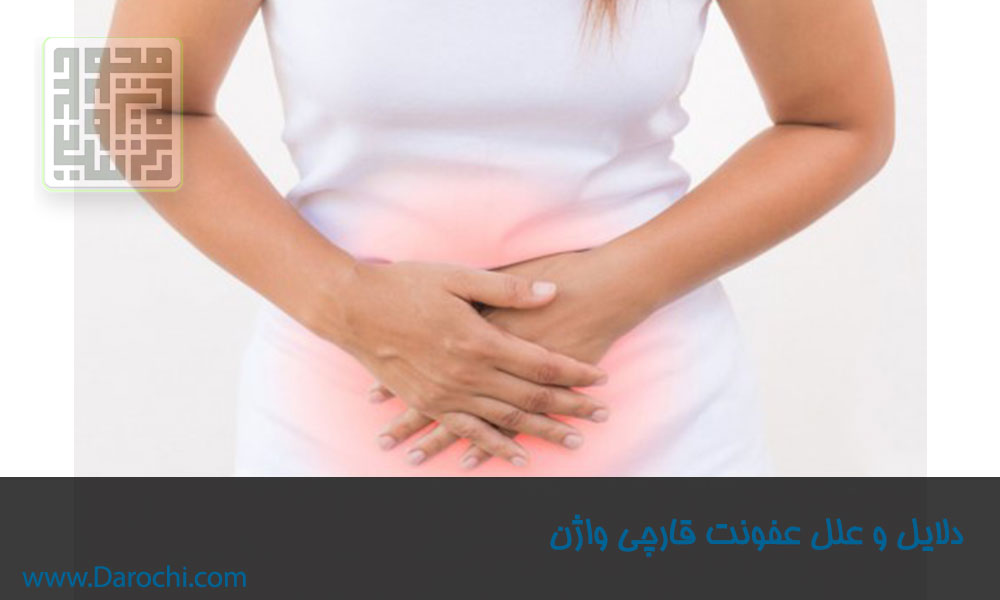 دلایل-و-علل-عفونت-قارچی-واژن