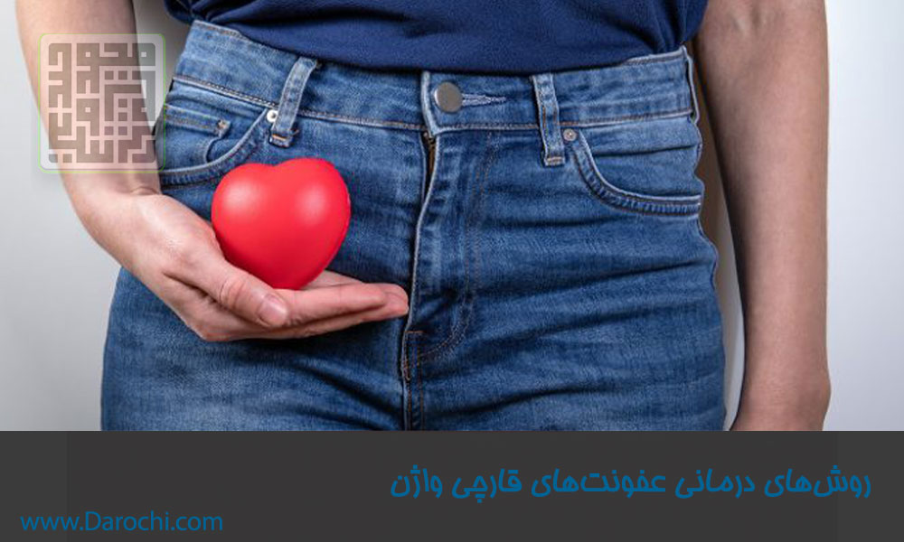 روش‌های-درمانی-عفونت‌های-قارچی-واژن