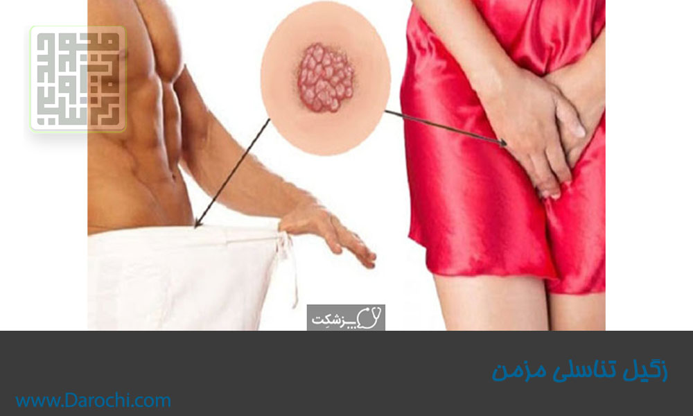 زگیل تناسلی--داروخانه داروچی