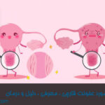 همه چیز در مورد عفونت قارچی ، معرفی ، دلیل و درمان(STIs)