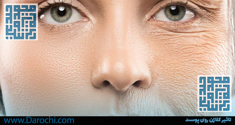تاثیر کلاژن روی پوست -داروخانه داروچی