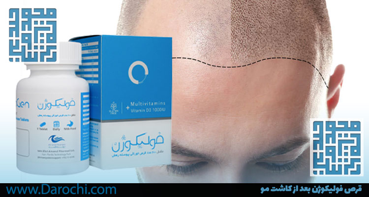 قرص فولیکوژن بعد از کاشت مو-داروخانه داروچی