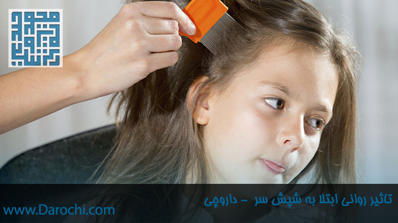 تاثیر روانی ابتلا به شپش سر-داروخانه آنلاین داروچی