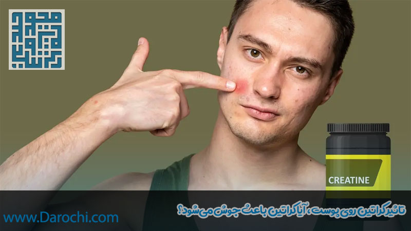 تاثیر کراتین روی پوست، آیا کراتین باعث جوش می‌شود؟