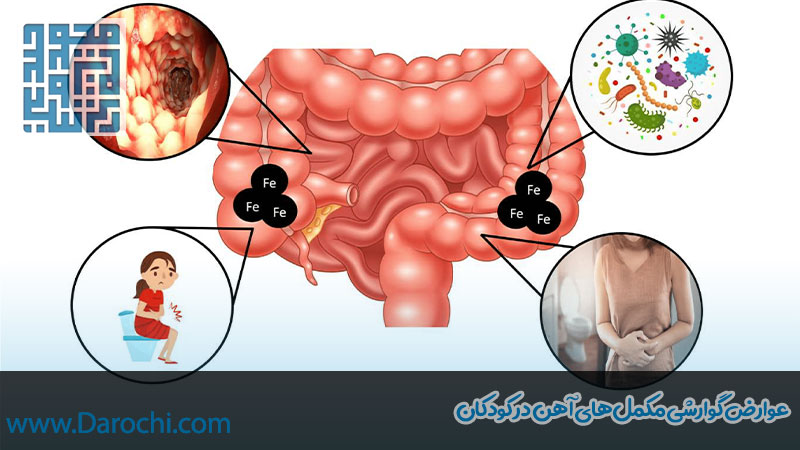 عوارض گوارشی مکمل آهن